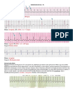 Exercicios de ECG Gabarito