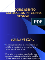 2-Colocacion de Sonda Vesical