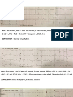 ECG at Sanglah Hospital