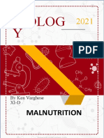 How Malnutrition Impacts Child Development