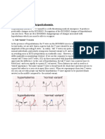 5 ECG Changes of Hyperkalaemia