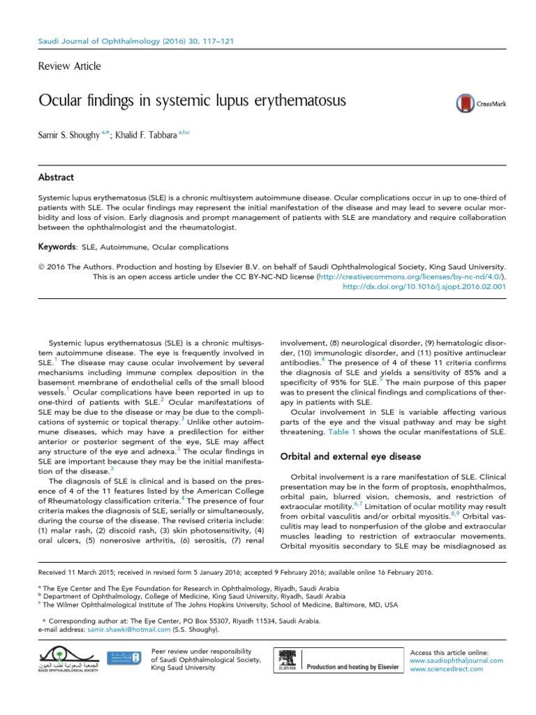 Ocular Findings in SLE  PDF  Vision  Diseases Of The Eye And Adnexa