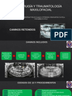 Cirugía de caninos retenidos