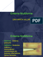 Eritemia Multiforme