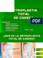Artroplastia 100506193917 Phpapp01