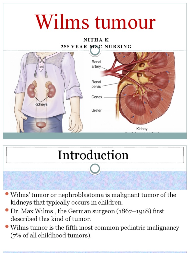 Wilms Tumour | PDF | Metastasis | Radiation Therapy