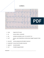 Soal Ekg Acs 2021