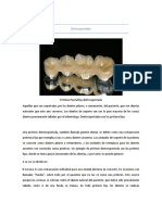 Tipos de Protesis Segun Su Soporte