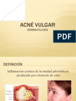 Acne Vulgaris