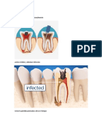 Imágenes Odontopediatría Endodoncia