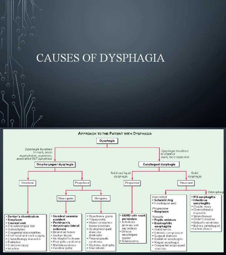 Causes of Dysphagia - Va | PDF