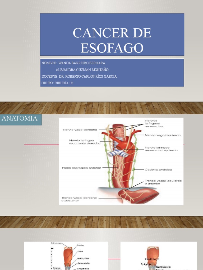 Cancer de Esofago | PDF | Cáncer de esófago | Cáncer