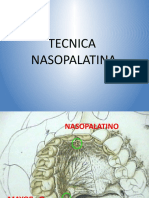 Tecnica Nasopalatina, Paltina Baja y Alta