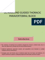 Ultrasound Guided Thoracic Paravertebral Block Techniques