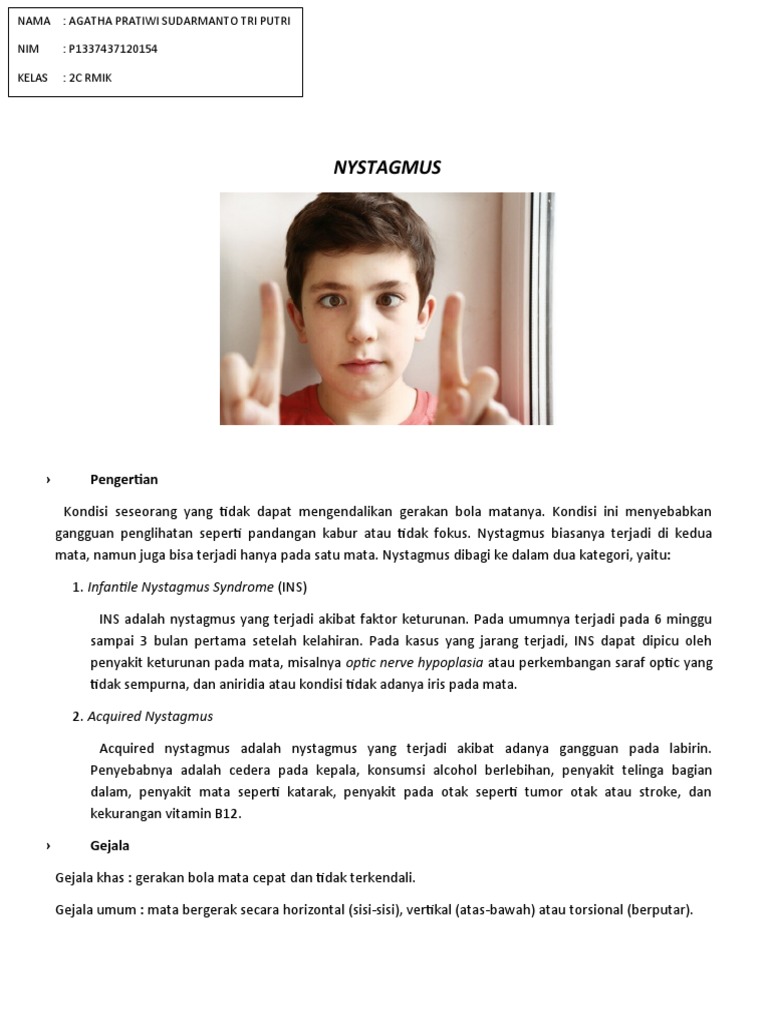 NYSTAGMUS PDF