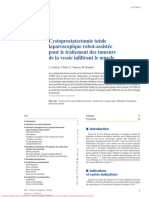 Cystoprostatectomie Totale Laparoscopique Robot-Assistée Pour Le Traitement Des Tumeurs de La Vessie Infiltrant Le Muscle