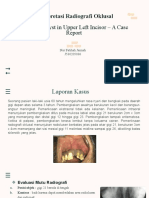 Interpretasi Radiografi Oklusal: Radicular Cyst in Upper Left Incisor - A Case