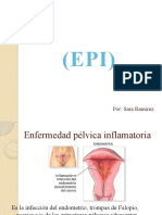 Enfermedad Pélvica Inflamatoria (EPI)