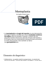 Metoplastia