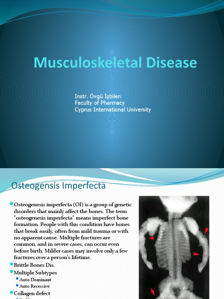 Overview of Musculoskeletal Diseases | PDF | Arthritis | Bone