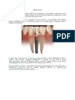 Implantul dentar