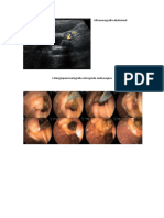 Ultrasonografía Abdominal
