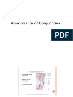 Abnormality of Conjunctiva