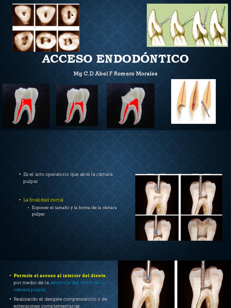 acceso-endod-ntico-pdf-boca-anatomia-dental