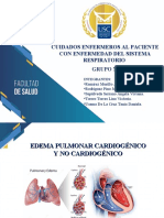 Edema Pulmonar Cardiogenico - Grupo N°3