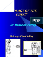 Chest Radiology