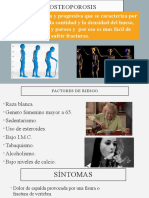 OSTEOPOROSIS Falta Gifs