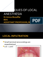 Techniques of Local Anesthesia: DR Amna Muzaffar BDS Assistant Professor, Omfs