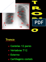 Aula 5 Tórax