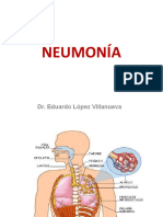 1 Neumonias
