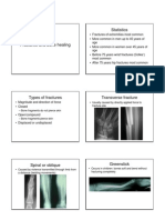 Fractures Bone06
