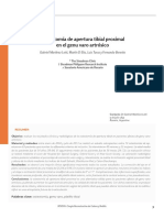 Ostesoimia Apetrura Tibial Proximal en Genu Varo Artrosico - MartinezLotti