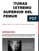 1246517209.Clase de Fx Del Extremo Sup Femur