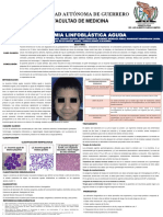 Leucemia Linfoblástica Aguda