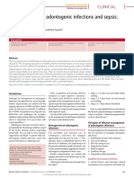 Management of Odontogenic Infections and Sepsis