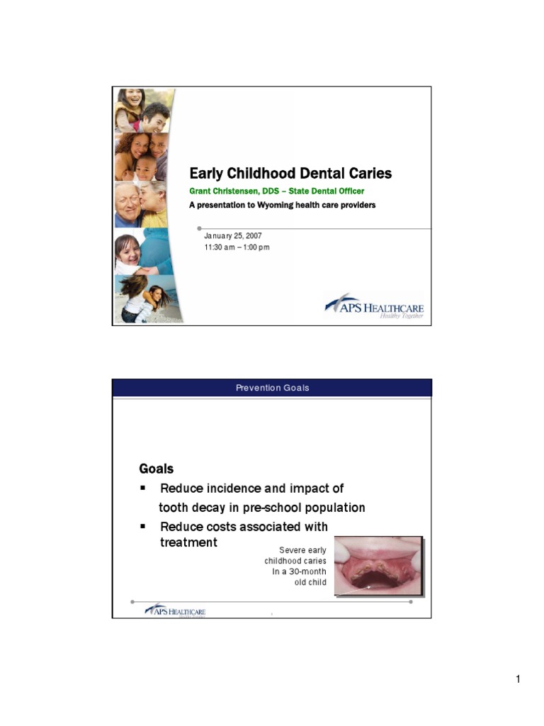 Early Childhood Dental Caries Prevention | PDF | Human Tooth | Tooth Enamel