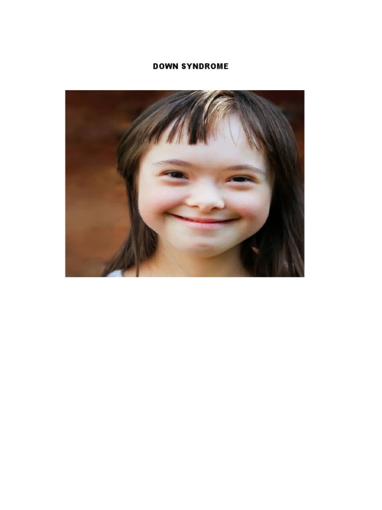 Down Syndrome Print | PDF