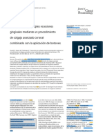 Treatment of Multiple Gingival Recessions - En.es