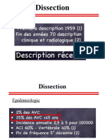 Dissection de L Artere Vertebrale