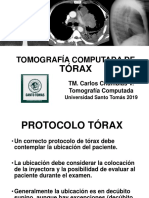 TC Tórax