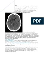 Practice Essentials: View Media Gallery Acute Stroke Vertigo: 5 Case-Based Diagnostic Puzzles