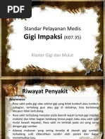 Download SPM Impaksi by Didit Istadi SN52223000 doc pdf
