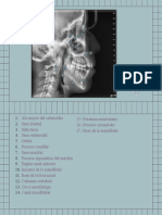 Radiología II - Lateral de Cráneo