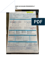 Scaling y Profilaxis Dental Historia y Fotos de Caso Clinico Salvador Luigi