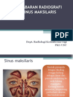 RD 4.2 Gambaran Radiografi Sinusitis