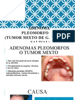 Expo Adenoma Pleomorfo
